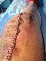 knee 1.jpg knee 1.jpg