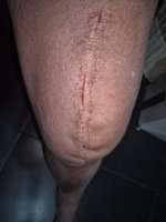 knee 2.jpg knee 2.jpg